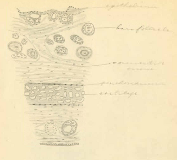 George N. Hemmer MD Papers